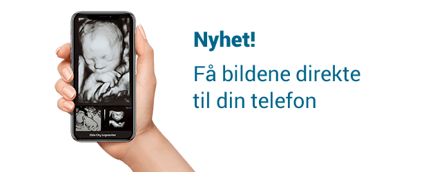 bildene direkte til din telefon